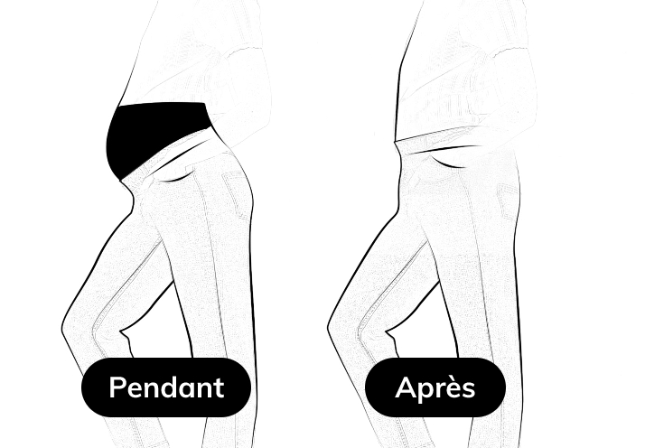Avant Après